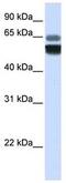 Sphingomyelin Phosphodiesterase 1 antibody, ab83354, Abcam, Western Blot image 