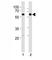 Histone Deacetylase 2 antibody, F51899-0.4ML, NSJ Bioreagents, Immunohistochemistry frozen image 