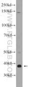 Zinc Finger DHHC-Type Containing 9 antibody, 24046-1-AP, Proteintech Group, Western Blot image 