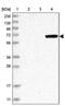 Mannan Binding Lectin Serine Peptidase 2 antibody, PA5-56111, Invitrogen Antibodies, Western Blot image 