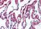 Collagen Type VI Alpha 1 Chain antibody, orb86844, Biorbyt, Immunohistochemistry paraffin image 