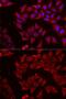 UMP-CMP kinase antibody, GTX33102, GeneTex, Immunofluorescence image 