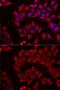 Cytidine/Uridine Monophosphate Kinase 1 antibody, GTX33102, GeneTex, Immunofluorescence image 