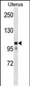 Mov10 RISC Complex RNA Helicase antibody, PA5-48726, Invitrogen Antibodies, Western Blot image 