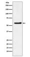 Dyskerin Pseudouridine Synthase 1 antibody, M01535-1, Boster Biological Technology, Western Blot image 