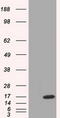 Tetratricopeptide Repeat Domain 32 antibody, TA501340S, Origene, Western Blot image 