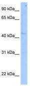 Histone-lysine N-methyltransferase SETD7 antibody, TA346842, Origene, Western Blot image 