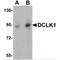 Doublecortin Like Kinase 1 antibody, TA306935, Origene, Western Blot image 