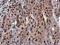 Poly(ADP-Ribose) Polymerase 1 antibody, GTX100573, GeneTex, Immunohistochemistry paraffin image 