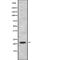 Fibroblast Growth Factor 21 antibody, abx215343, Abbexa, Western Blot image 