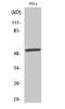 Myocyte Enhancer Factor 2A antibody, A01398S408, Boster Biological Technology, Western Blot image 