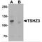 Teashirt Zinc Finger Homeobox 3 antibody, MBS150201, MyBioSource, Western Blot image 