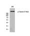 TSC Complex Subunit 2 antibody, A00229T1462-2, Boster Biological Technology, Western Blot image 