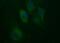 HAUS Augmin Like Complex Subunit 7 antibody, MA5-26312, Invitrogen Antibodies, Immunocytochemistry image 