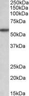 Transforming Growth Factor Beta Receptor 1 antibody, LS-B9436, Lifespan Biosciences, Western Blot image 