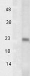 PTGES3L-AARSD1 Readthrough antibody, TA326408, Origene, Western Blot image 