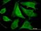 Eukaryotic Translation Initiation Factor 2 Subunit Beta antibody, H00008894-M09, Novus Biologicals, Immunocytochemistry image 