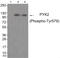 Protein-tyrosine kinase 2-beta antibody, 79-886, ProSci, Western Blot image 