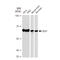 ETS Transcription Factor ELK1 antibody, GTX02854, GeneTex, Western Blot image 