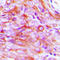 Solute Carrier Family 5 Member 3 antibody, LS-C358323, Lifespan Biosciences, Immunohistochemistry paraffin image 