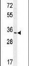 Ribonuclease T2 antibody, PA5-24253, Invitrogen Antibodies, Western Blot image 