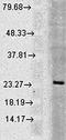 RAB5A, Member RAS Oncogene Family antibody, orb67543, Biorbyt, Western Blot image 