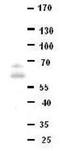 Downstream Neighbor Of SON antibody, GTX46517, GeneTex, Western Blot image 