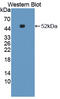 Kynurenine--oxoglutarate transaminase 1 antibody, abx128092, Abbexa, Western Blot image 