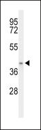 Acyl-CoA Dehydrogenase Family Member 8 antibody, LS-C155902, Lifespan Biosciences, Western Blot image 