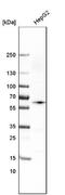 RANBP2-Type And C3HC4-Type Zinc Finger Containing 1 antibody, NBP2-59048, Novus Biologicals, Western Blot image 