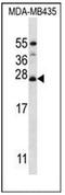 Mitochondrial Ribosomal Protein L50 antibody, AP53677PU-N, Origene, Western Blot image 