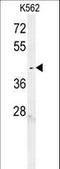 Chromosome 6 Open Reading Frame 58 antibody, LS-C168181, Lifespan Biosciences, Western Blot image 