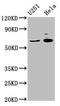 Gamma-Aminobutyric Acid Type A Receptor Alpha4 Subunit antibody, LS-C369648, Lifespan Biosciences, Western Blot image 