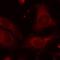 Nuclear Factor Kappa B Subunit 1 antibody, NB100-82069, Novus Biologicals, Immunofluorescence image 
