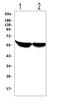 Cytochrome P450 Family 2 Subfamily E Member 1 antibody, GTX12194, GeneTex, Western Blot image 