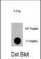 TSC Complex Subunit 2 antibody, abx032002, Abbexa, Immunofluorescence image 