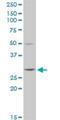 Glutathione S-Transferase Theta 2 (Gene/Pseudogene) antibody, H00002953-D01P, Novus Biologicals, Western Blot image 