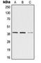 Zinc Binding Alcohol Dehydrogenase Domain Containing 2 antibody, orb215409, Biorbyt, Western Blot image 