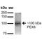 Peroxisomal Biogenesis Factor 6 antibody, MA5-27670, Invitrogen Antibodies, Western Blot image 