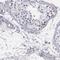 Cyclin Dependent Kinase Like 5 antibody, NBP1-84881, Novus Biologicals, Immunohistochemistry paraffin image 