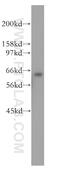 SSX Family Member 2 Interacting Protein antibody, 13694-1-AP, Proteintech Group, Western Blot image 