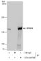 SURP And G-Patch Domain Containing 2 antibody, GTX129798, GeneTex, Immunoprecipitation image 