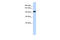 PAX3 And PAX7 Binding Protein 1 antibody, 26-247, ProSci, Western Blot image 