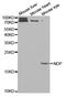 Norrin Cystine Knot Growth Factor NDP antibody, LS-C331790, Lifespan Biosciences, Western Blot image 