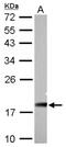 NADH:Ubiquinone Oxidoreductase Subunit AB1 antibody, NBP1-31682, Novus Biologicals, Western Blot image 