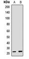 SP5 antibody, LS-C667988, Lifespan Biosciences, Western Blot image 