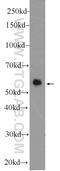 Dipeptidyl Peptidase 9 antibody, 11568-1-AP, Proteintech Group, Western Blot image 