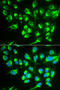 Solute Carrier Family 22 Member 5 antibody, 16-743, ProSci, Immunofluorescence image 