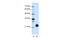 Transmembrane emp24 domain-containing protein 4 antibody, A12647, Boster Biological Technology, Western Blot image 