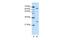 Nudix Hydrolase 21 antibody, GTX47334, GeneTex, Western Blot image 